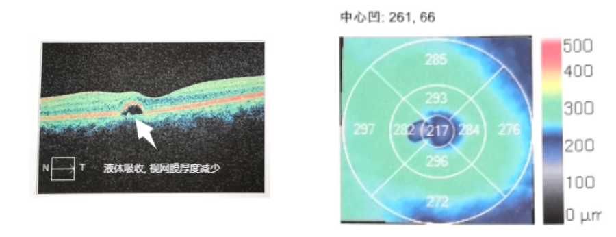 1711445045868257.png image.png