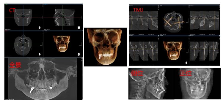 1711435122965392.png 圖片4.png