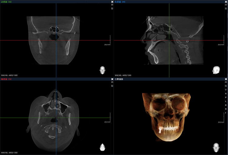 1711435108985536.png 圖片3.png