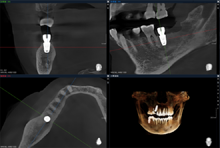 1711435131605888.png 圖片5.png