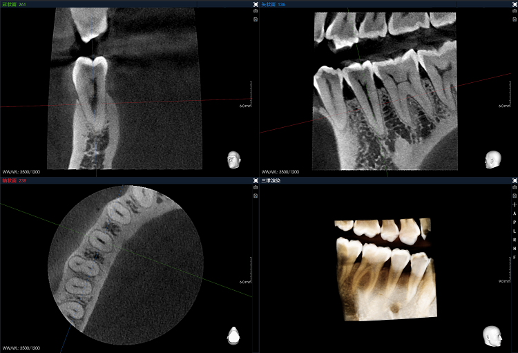 1711435146943607.png 圖片6.png