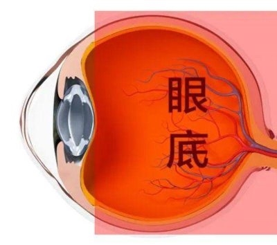 愛爾眼科：激光“打”在眼內(nèi)還能治眼??？(圖1)