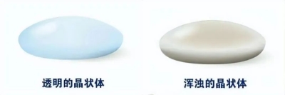 愛爾眼科：白內(nèi)障不會“缺席”只會“遲到”？(圖3)